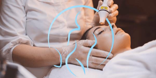 Ideal image laser store hair removal