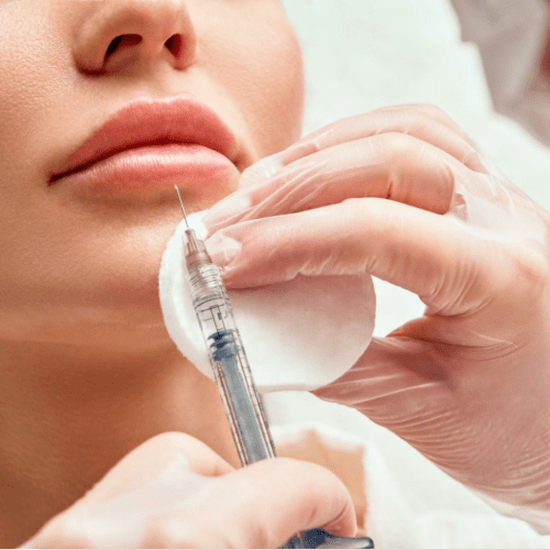 Plump lips of a woman with a needle for dermal lip filler injection of hyaluronic acid
