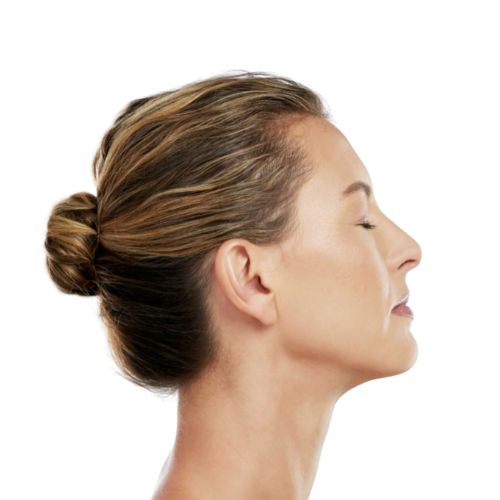 Areas of the body to get Sofwave treatment