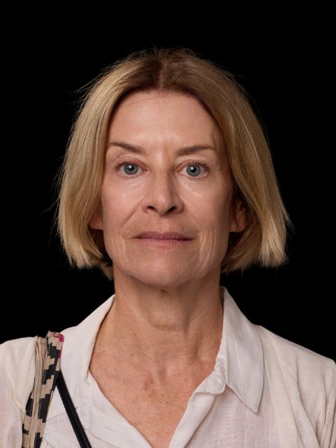 After picture: triLift treatment for mature woman in Montreal at Ideal Body Clinic