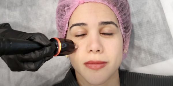 Book your triLift sessions at Ideal Body Clinic in Montreal