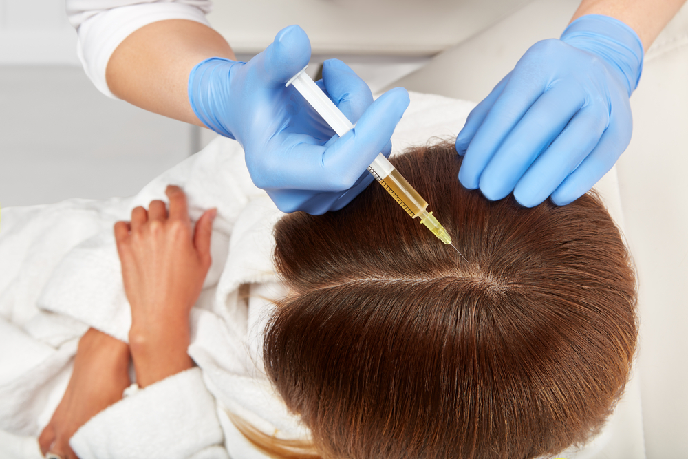 Hair Restoration with PRP Therapy: A Natural Solution for Hair Loss